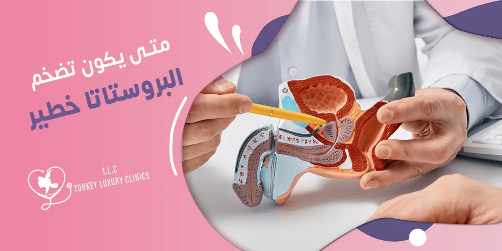 متى يكون تضخم البروستاتا خطير؟ احتباس البول الإشارة الأولى
