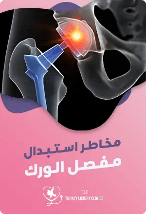 مخاطر ومضاعفات استبدال مفصل الوركfeatured image
