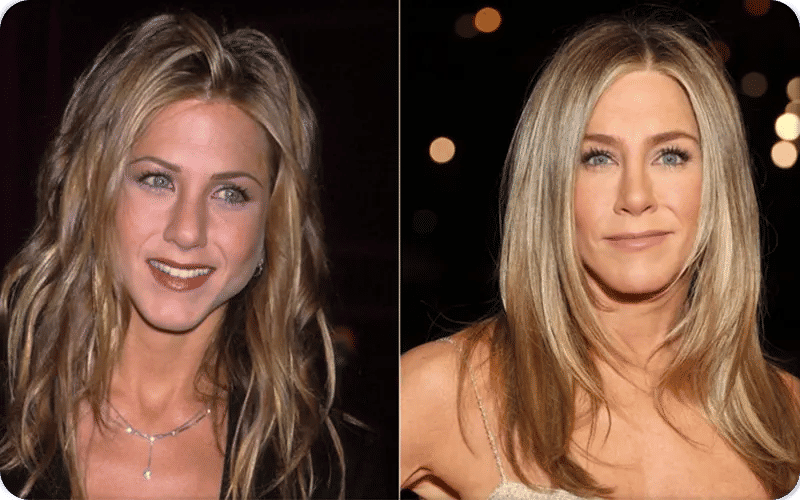 Jennifer Aniston chirurgie avant après-2