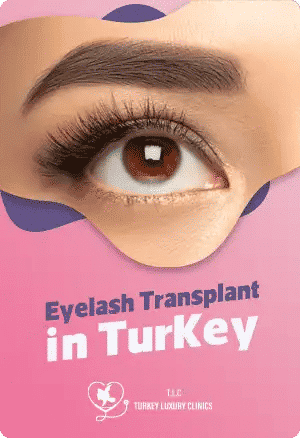 Trasplante de Pestañas en Turquía: Pestañas Naturales y Voluminosasfeatured image
