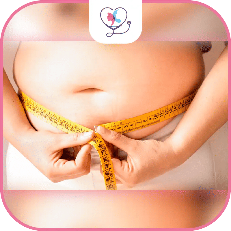 Qu'est-ce qu'une sleeve gastrectomie ratée ?