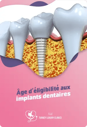 Age d'éligibilité aux implants dentaires