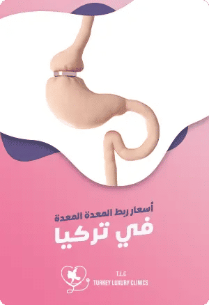 تكلفة عملية ربط المعدة في تركياfeatured image