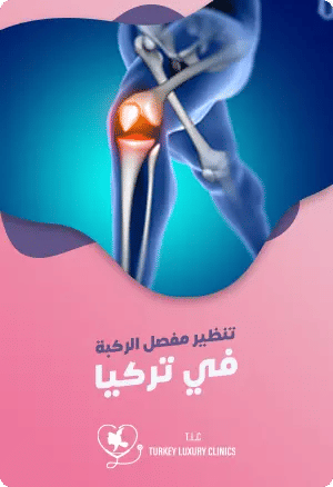 عملية تنظير مفصل الركبة في تركياfeatured image