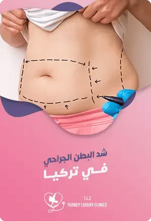 عملية شد البطن في تركيا: أفضل النتائج والتكاليفfeatured image