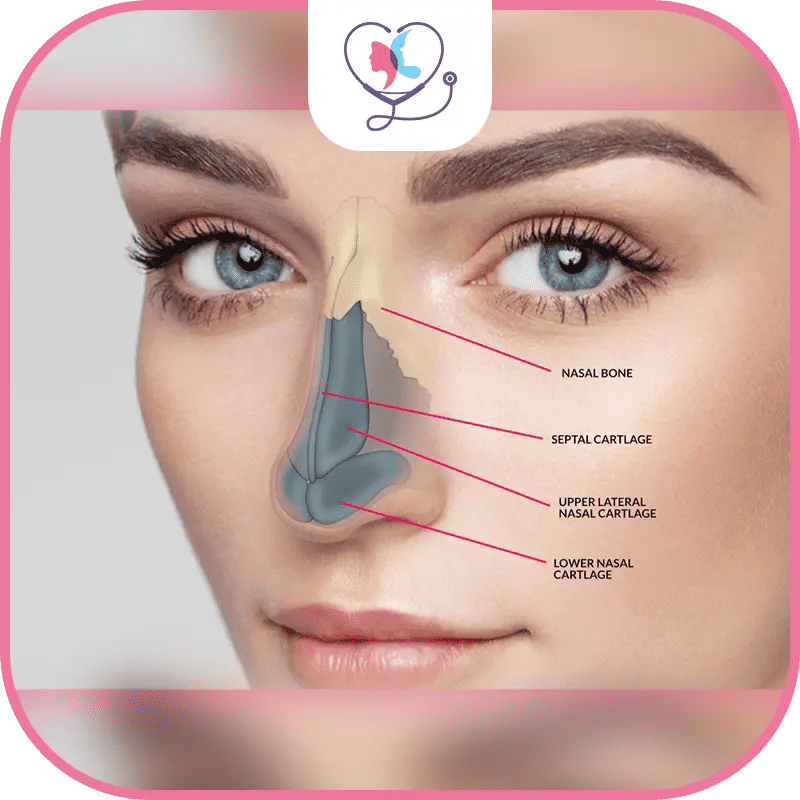 Rhinoplastie en Turquie