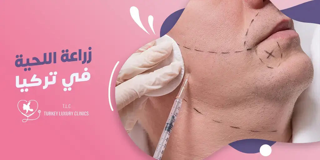 زراعة اللحية في تركيا - إطلالة جديدة وجذابة