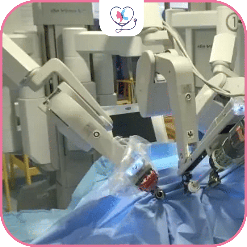 رابعاً وقت جراحة ومدة الإقامة بالمشفى أقل