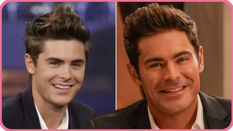 Zac Efron Face Changes