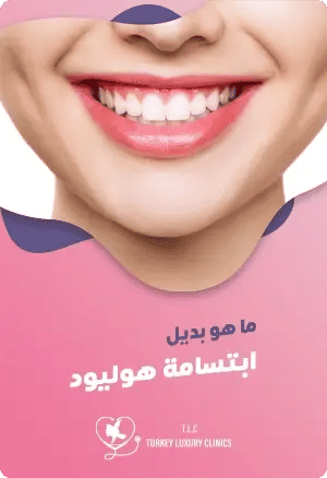 ما هو بديل ابتسامة هوليود؟featured image