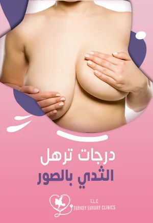 درجات ترهل الثدي بالصور: صور حقيقية مع العلاج المناسب