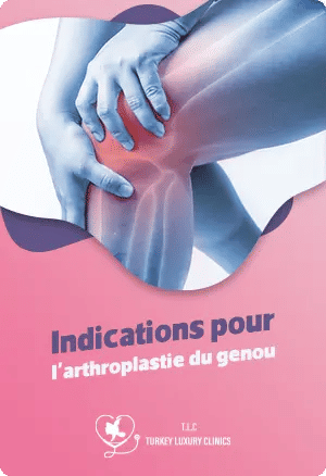 Indications pour l'arthroplastie du genoufeatured image