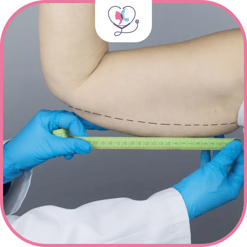 ماهي عملية شد الذراعين؟ 