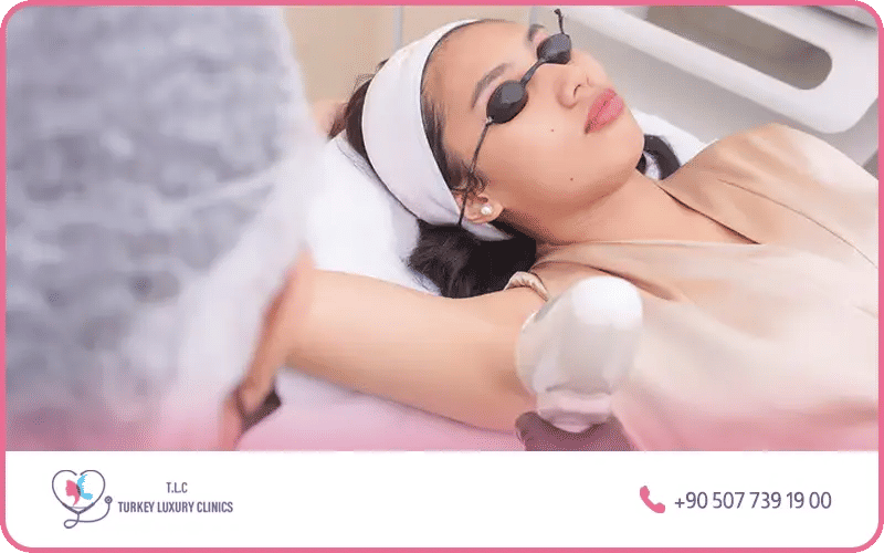 blanchiment au laser aisselles blanchiment au laser aisselles