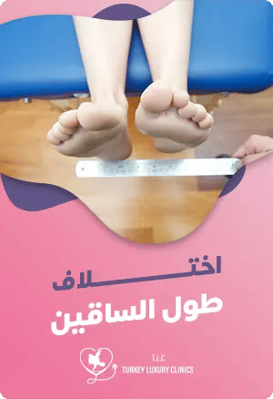 اختلاف طول الساقين: الأعراض والأسباب والعلاجfeatured image
