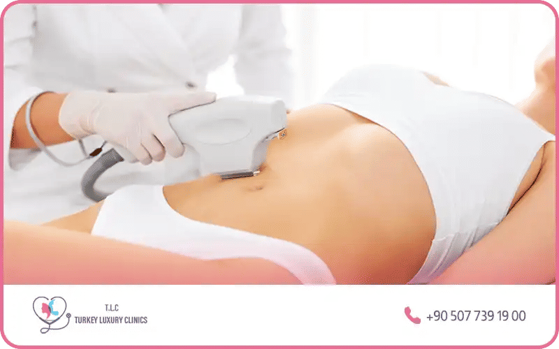 Méthodes non chirurgicales pour perdre la graisse du ventre