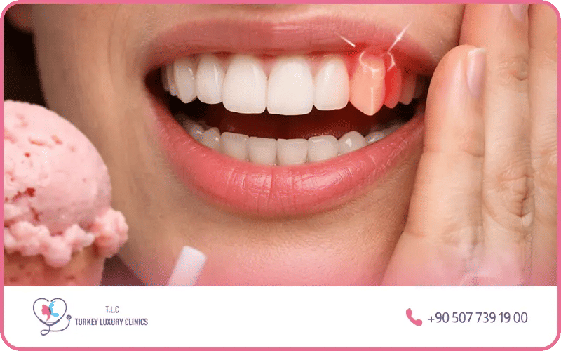 Risques et effets secondaires du blanchiment dentaire au laser Risques et effets secondaires du blanchiment dentaire au laser