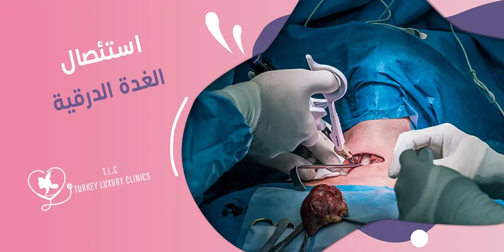 استئصال الغدة الدرقية: الأسباب وأنواع الاستئصال مع النتائج