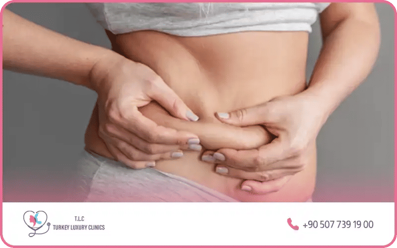 Les causes d’une liposuccion du ventre ratée