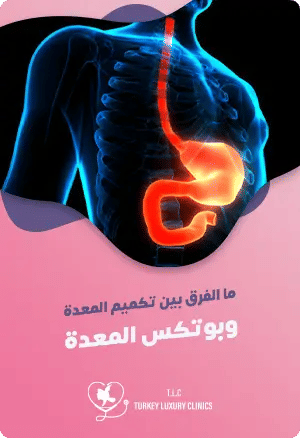 ما الفرق بين تكميم المعدة وبوتكس المعدة؟featured image