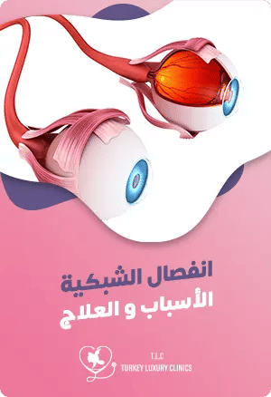 علاج انفصال الشبكية في تركياfeatured image
