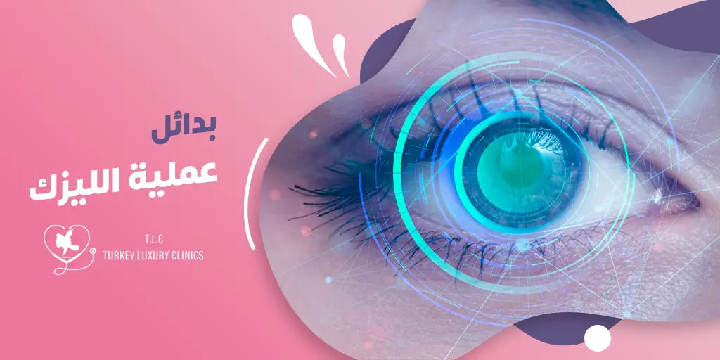 بدائل عملية الليزك