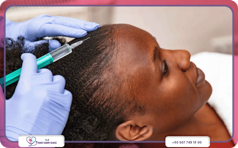 خطوات زراعة الشعر بتقنية الأفرو