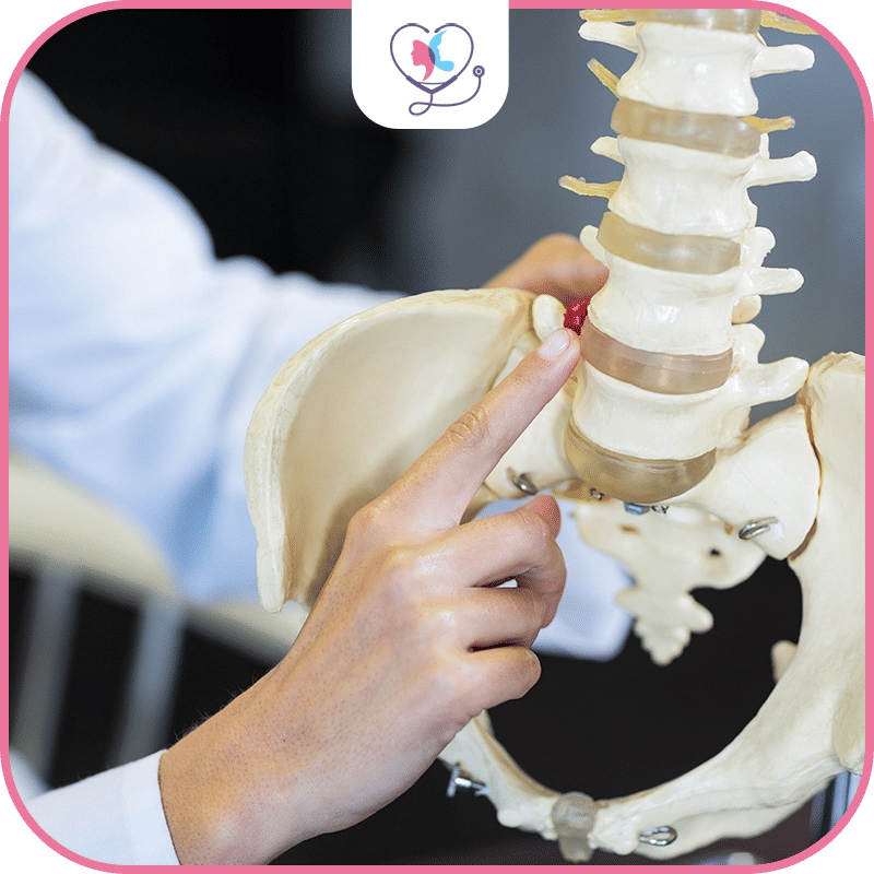 ما هي جراحة تثبيت الفقرات؟