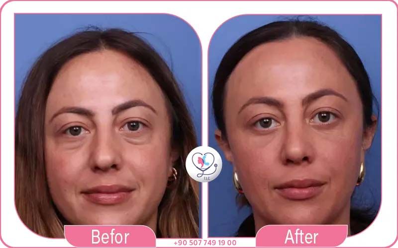 سابعاً: رسوم الاستشارة