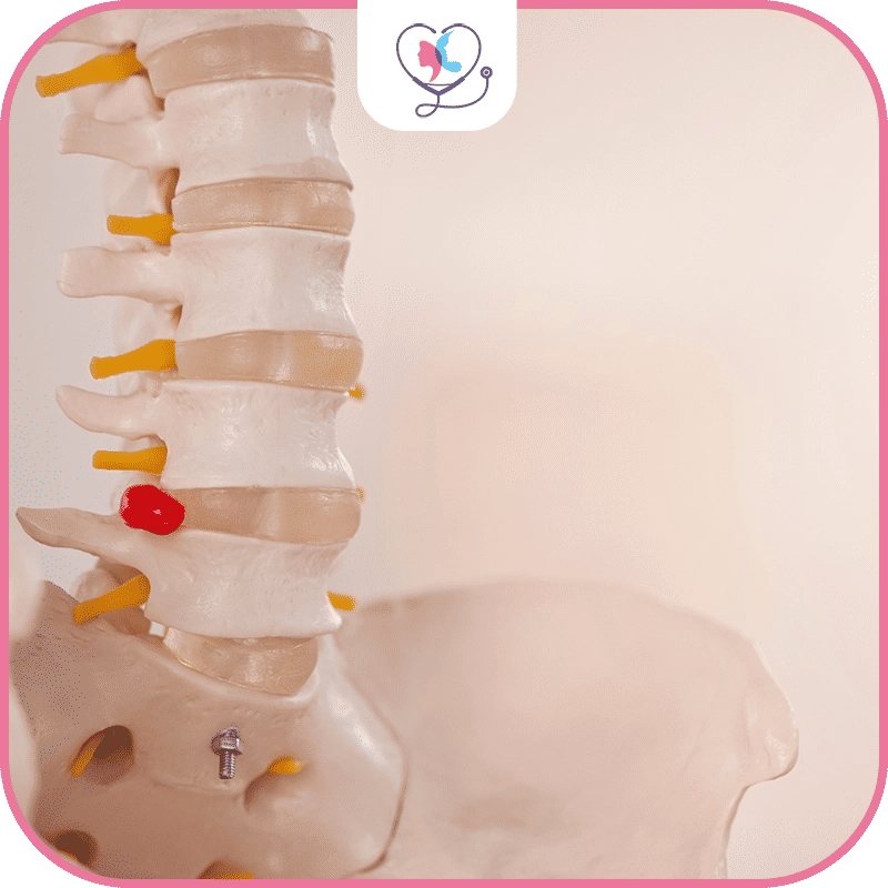 أفضل جراحي العمود الفقري في تركيا