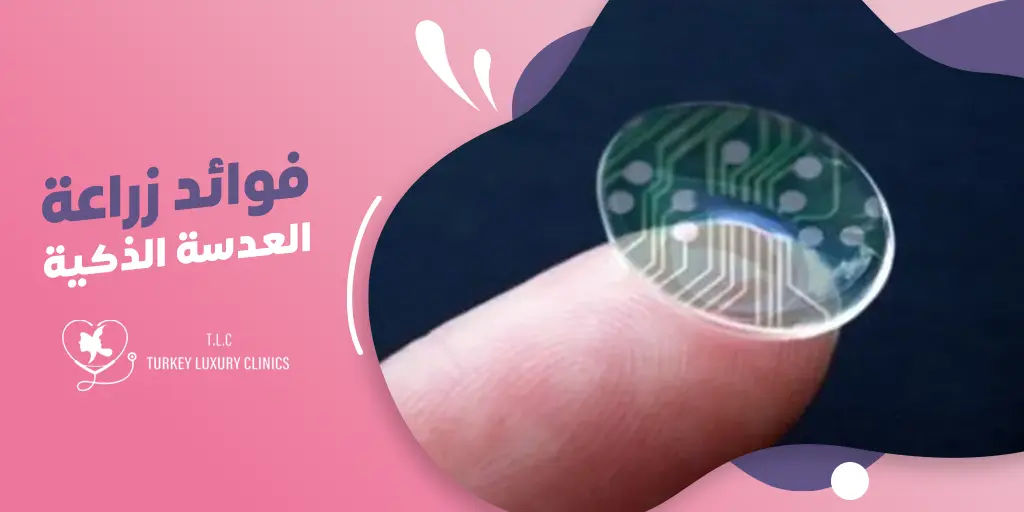 فوائد زراعة العدسة الذكية 