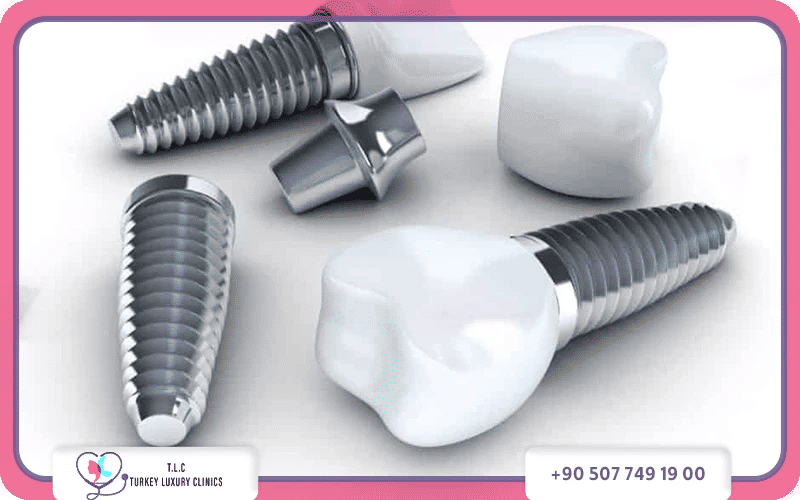 ما هي افضل انواع زرعات الاسنان؟