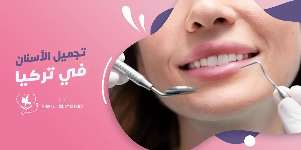 اكتشف سحر تجميل الأسنان في تركيا