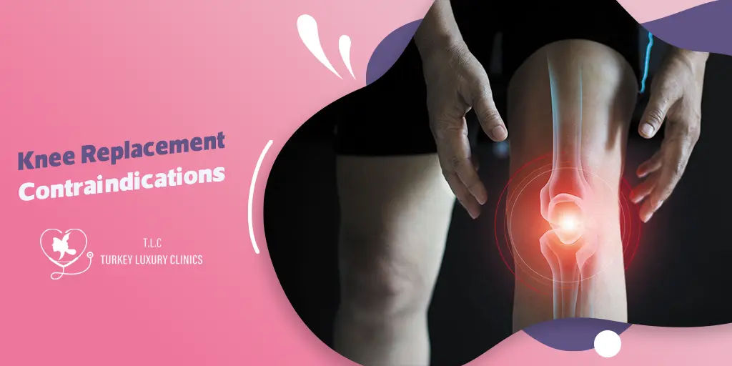 Knee Replacement Contraindications: Who Should Avoid this Surgery?