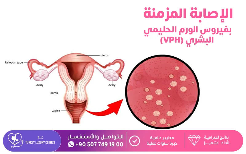 بفيروس الورم الحليمي البشري (HPV) بفيروس الورم الحليمي البشري (HPV)