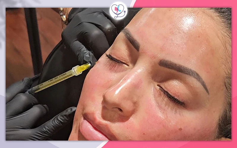 Exosome Injections Under the Eyes