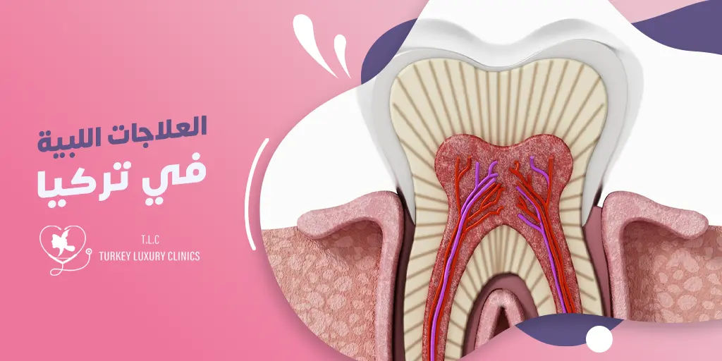 العلاجات اللبية في تركيا
