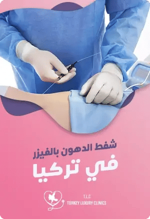 شفط الدهون بالفيزر في تركيا: دليلك الشاملfeatured image