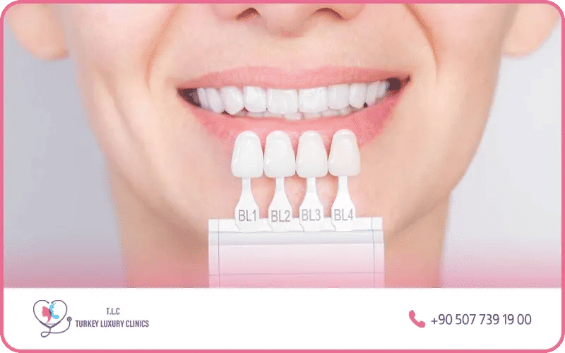 Factors affecting zirconium crown cost in Turkey – clinic location, material quality, and number of crowns required