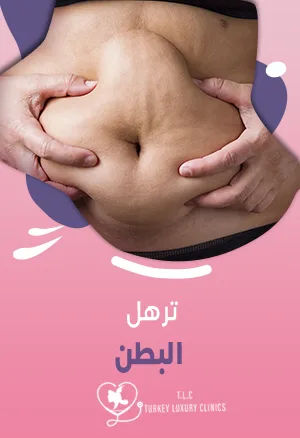 ترهل البطن: الأسباب والدرجات والأنواع والعلاج بعملية شد البطن