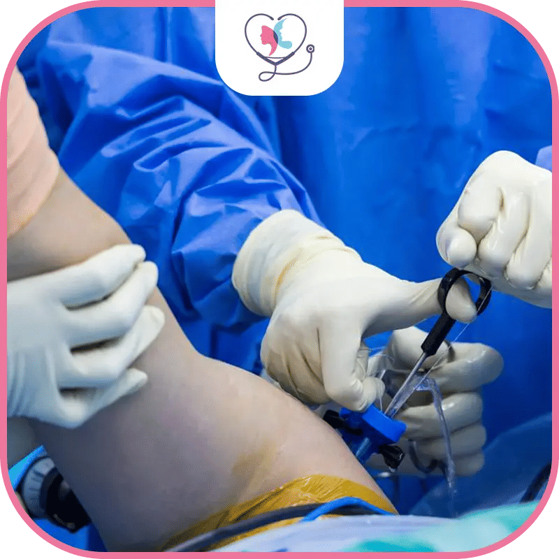 استبدال مفصل الكتف في تركيا