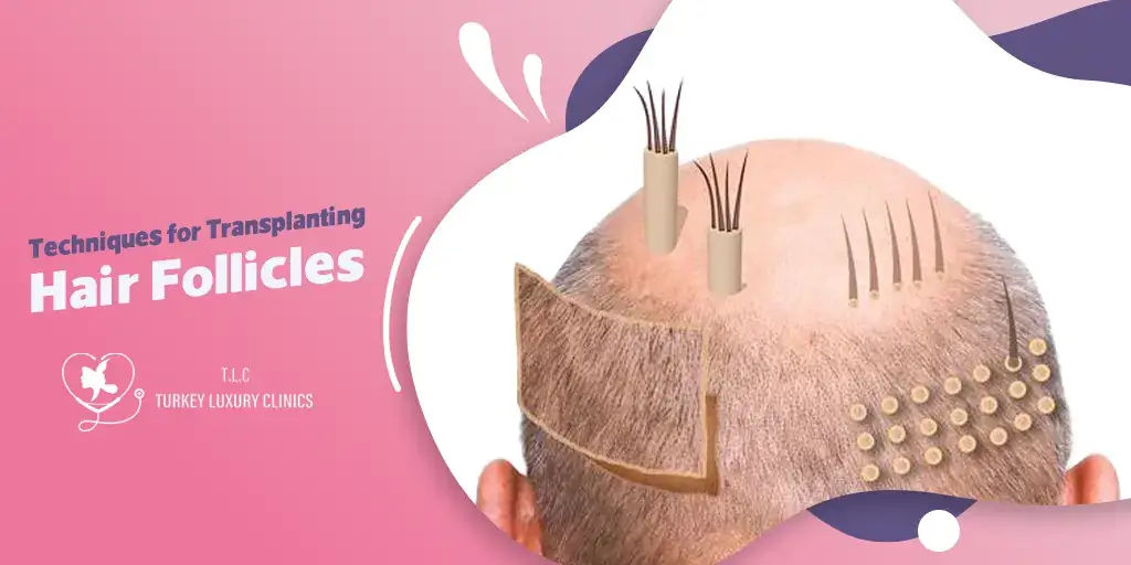 Techniken zur Haartransplantation