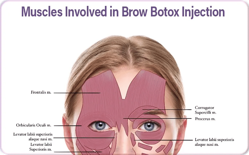 Muscles Involved in Brow Botox Injection 