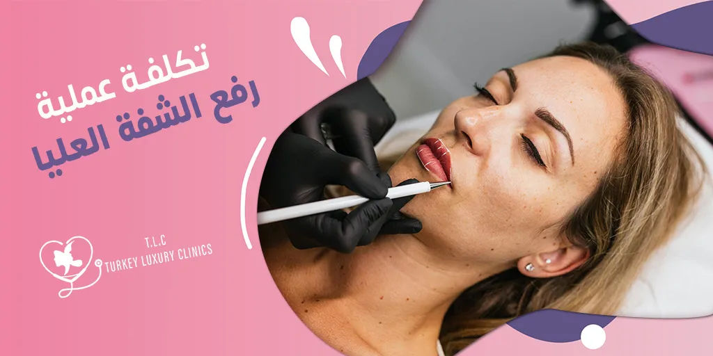 تكلفة عملية رفع الشفة العليا: تركيا مقارنة مع باقي الدول 2026