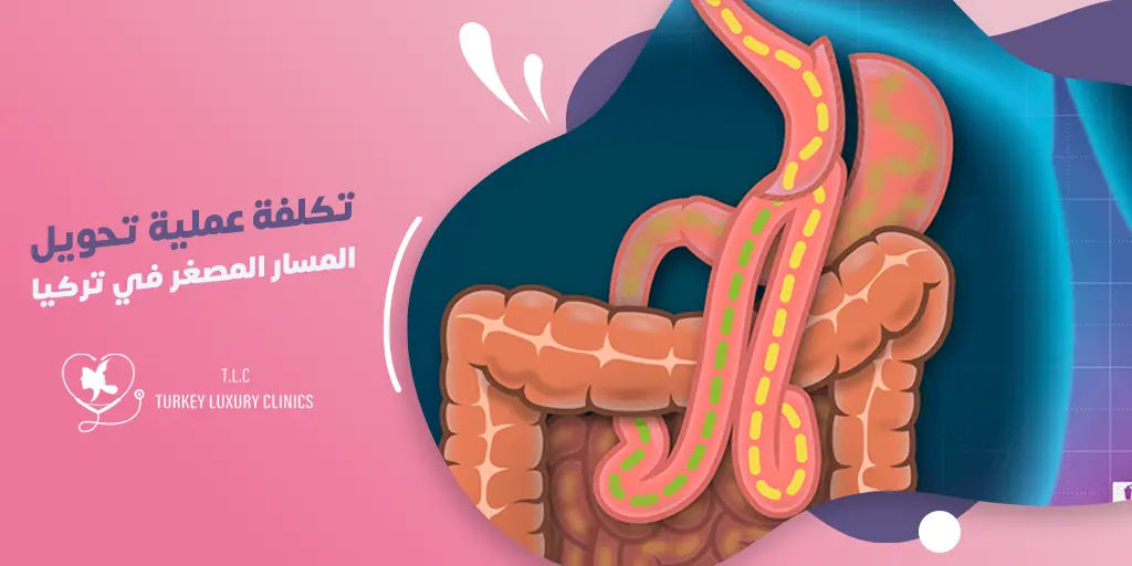 تكلفة عملية تحويل المسار المصغر في تركيا