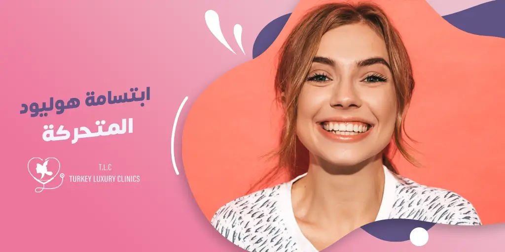 ماهي ابتسامة هوليود المتحركة؟