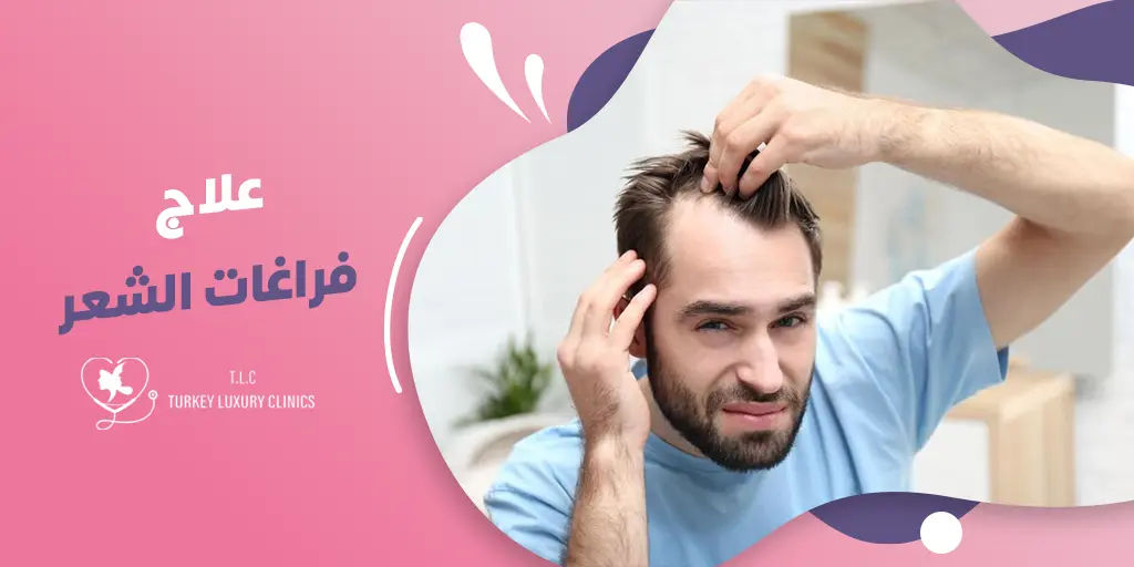 علاج فراغات الشعر: أفضل الطرق الطبيعية والطبية لاستعادة كثافته