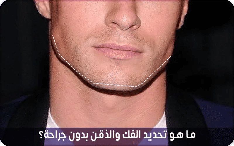 ما هو تحديد الفك والذقن بدون جراحة؟