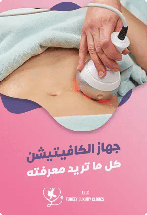جهاز الكافيتيشن: كل ما تريد معرفتهfeatured image