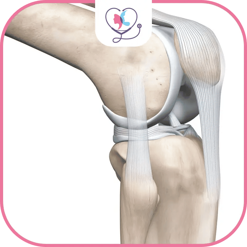 عملية تغيير مفصل الركبة في تركيا: دليلك الشامل